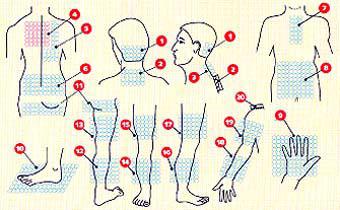 akupresurne body